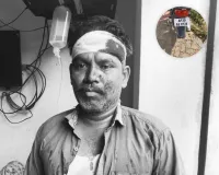 రెండు బైక్లు ఢీ ఇద్దరికీ గాయాలు